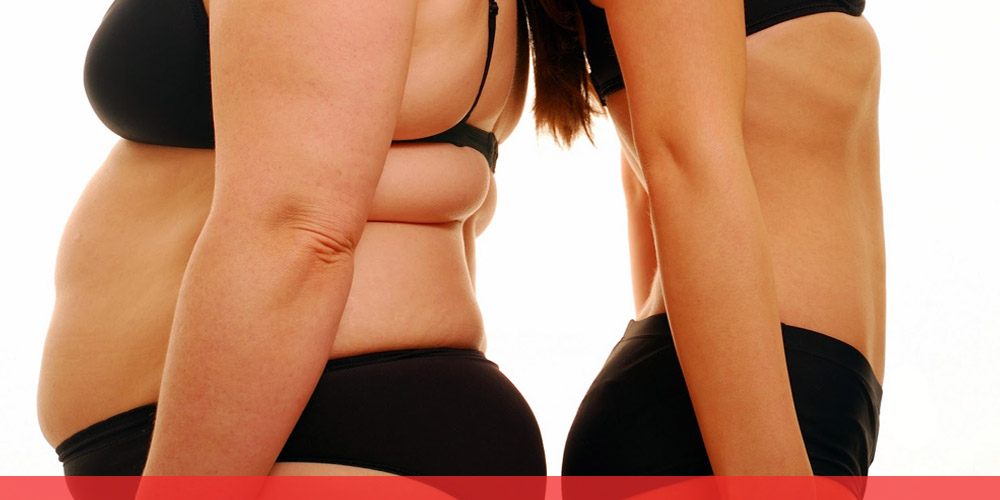post-gastric-bypass